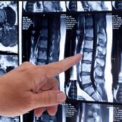 Resonancia Magnética Lumbar en Madrid  DMI Coslada  al precio de 115€