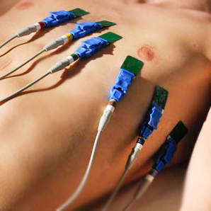 Electrocardiograma